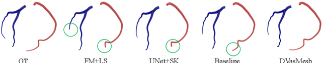 Figure 4 for DVasMesh: Deep Structured Mesh Reconstruction from Vascular Images for Dynamics Modeling of Vessels