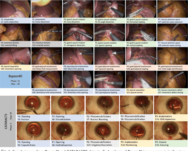 Figure 1 for Weakly Supervised Temporal Convolutional Networks for Fine-grained Surgical Activity Recognition