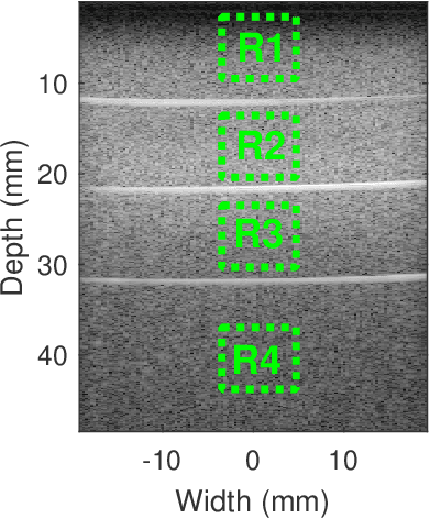 Figure 1 for Constrained and Regularized Quantitative Ultrasound Parameter Estimation using ADMM