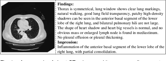 Figure 1 for MvKeTR: Chest CT Report Generation with Multi-View Perception and Knowledge Enhancement