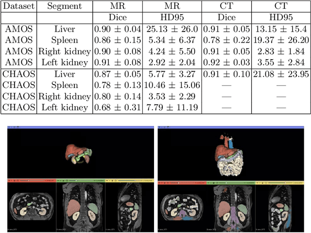 Figure 4 for Towards Automatic Abdominal MRI Organ Segmentation: Leveraging Synthesized Data Generated From CT Labels