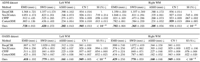 Figure 2 for Diffeomorphic Deformation via Sliced Wasserstein Distance Optimization for Cortical Surface Reconstruction