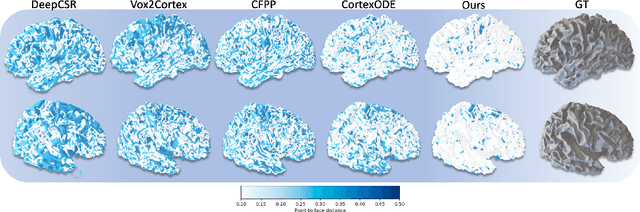 Figure 3 for Diffeomorphic Deformation via Sliced Wasserstein Distance Optimization for Cortical Surface Reconstruction