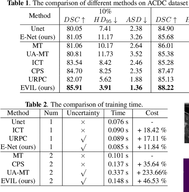 Figure 3 for EVIL: Evidential Inference Learning for Trustworthy Semi-supervised Medical Image Segmentation