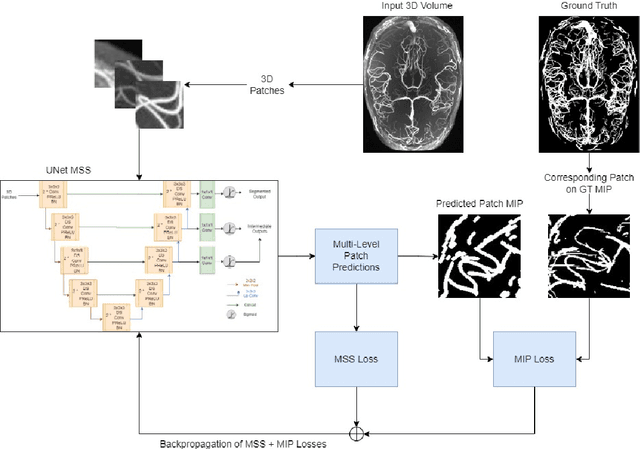 Figure 1 for SPOCKMIP: Segmentation of Vessels in MRAs with Enhanced Continuity using Maximum Intensity Projection as Loss