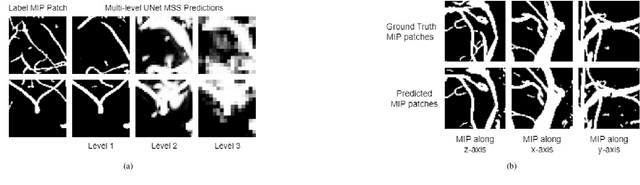 Figure 3 for SPOCKMIP: Segmentation of Vessels in MRAs with Enhanced Continuity using Maximum Intensity Projection as Loss