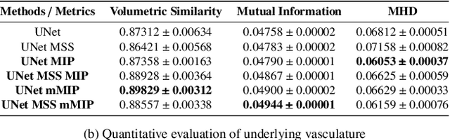 Figure 4 for SPOCKMIP: Segmentation of Vessels in MRAs with Enhanced Continuity using Maximum Intensity Projection as Loss