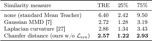 Figure 4 for A denoised Mean Teacher for domain adaptive point cloud registration