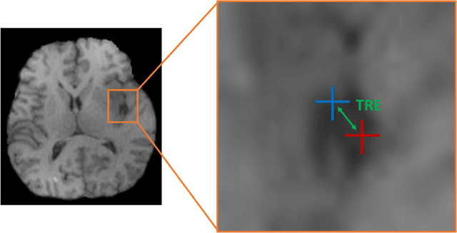 Figure 3 for Primitive Simultaneous Optimization of Similarity Metrics for Image Registration