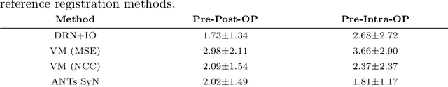 Figure 4 for Primitive Simultaneous Optimization of Similarity Metrics for Image Registration