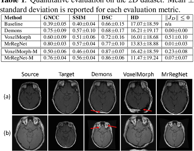 Figure 2 for MrRegNet: Multi-resolution Mask Guided Convolutional Neural Network for Medical Image Registration with Large Deformations