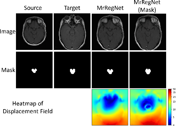 Figure 4 for MrRegNet: Multi-resolution Mask Guided Convolutional Neural Network for Medical Image Registration with Large Deformations