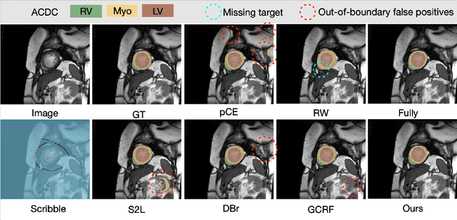 Figure 4 for AttenScribble: Attentive Similarity Learning for Scribble-Supervised Medical Image Segmentation