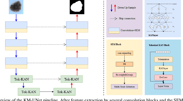 Figure 1 for KM-UNet KAN Mamba UNet for medical image segmentation