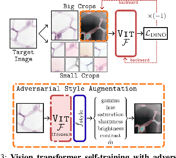 Figure 4 for Source-Free Open-Set Domain Adaptation for Histopathological Images via Distilling Self-Supervised Vision Transformer