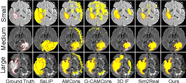 Figure 3 for CLISC: Bridging clip and sam by enhanced cam for unsupervised brain tumor segmentation