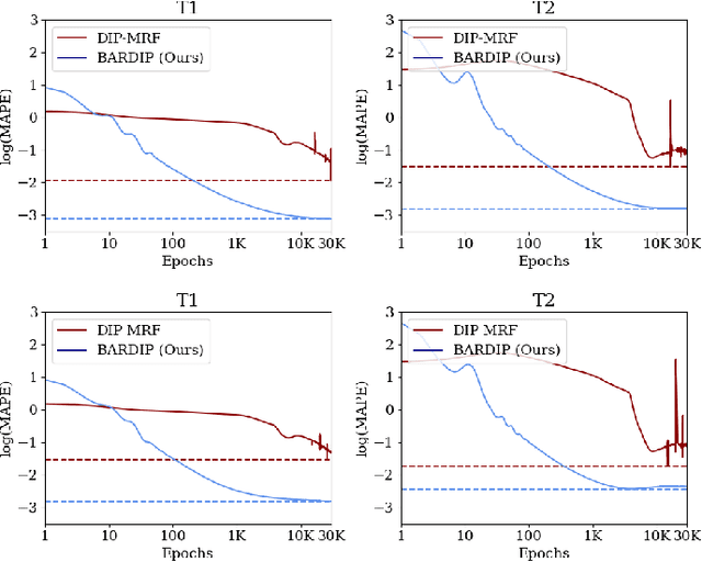 Figure 3 for Deep Image Priors for Magnetic Resonance Fingerprinting with pretrained Bloch-consistent denoising autoencoders