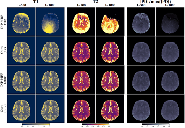 Figure 4 for Deep Image Priors for Magnetic Resonance Fingerprinting with pretrained Bloch-consistent denoising autoencoders