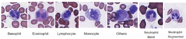 Figure 1 for Stain Normalization of Hematology Slides using Neural Color Transfer