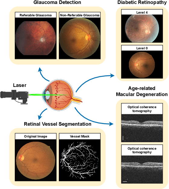 Figure 1 for Deep Learning for Ophthalmology: The State-of-the-Art and Future Trends