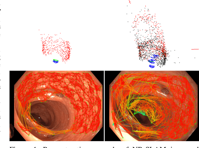 Figure 1 for NR-SLAM: Non-Rigid Monocular SLAM