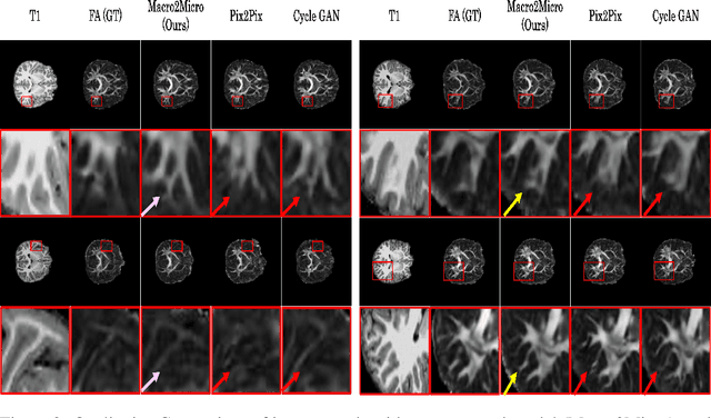 Figure 4 for Macro2Micro: Cross-modal Magnetic Resonance Imaging Synthesis Leveraging Multi-scale Brain Structures