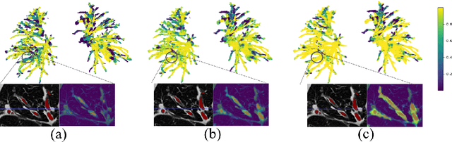 Figure 3 for GDDS: Pulmonary Bronchioles Segmentation with Group Deep Dense Supervision