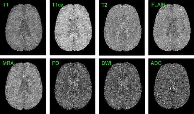 Figure 4 for BrainMVP: Multi-modal Vision Pre-training for Brain Image Analysis using Multi-parametric MRI