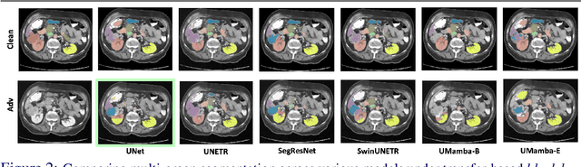 Figure 2 for On Evaluating Adversarial Robustness of Volumetric Medical Segmentation Models