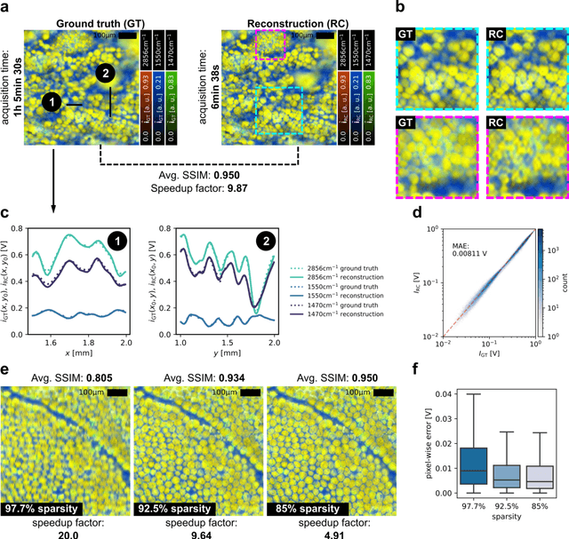 Figure 3 for Bayesian reconstruction of sparse raster-scanned mid-infrared optoacoustic signals enables fast, label-free chemical microscopy