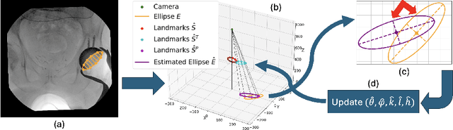 Figure 1 for 2D/3D Registration of Acetabular Hip Implants Under Perspective Projection and Fully Differentiable Ellipse Fitting