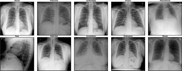 Figure 1 for Fixed-Budget Parameter-Efficient Training with Frozen Encoders Improves Multimodal Chest X-Ray Classification