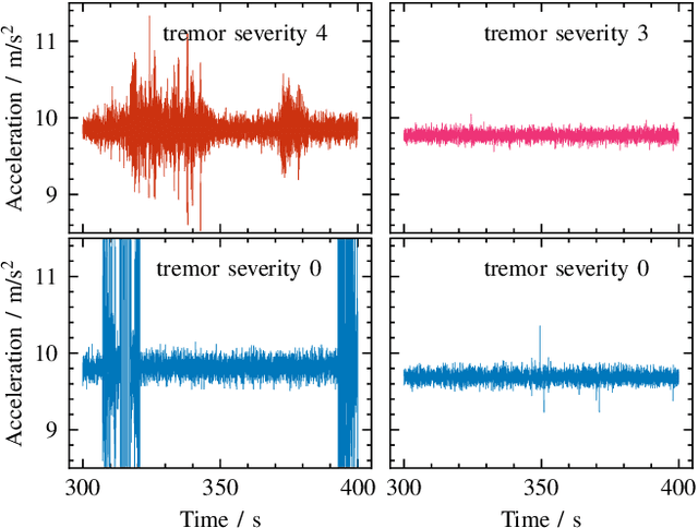 Figure 3 for Time Series Classification for Detecting Parkinson's Disease from Wrist Motions