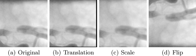 Figure 3 for Coronary Artery Disease Classification with Different Lesion Degree Ranges based on Deep Learning