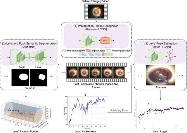 Figure 1 for Predicting Postoperative Intraocular Lens Dislocation in Cataract Surgery via Deep Learning