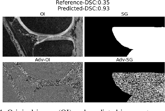 Figure 4 for Trust, but Verify: Robust Image Segmentation using Deep Learning