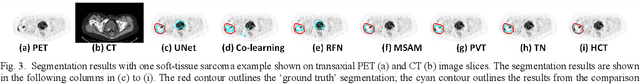 Figure 3 for Hyper-Connected Transformer Network for Co-Learning Multi-Modality PET-CT Features