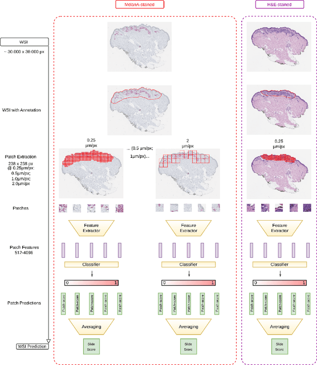 Figure 2 for Evaluating Deep Learning-based Melanoma Classification using Immunohistochemistry and Routine Histology: A Three Center Study