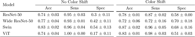 Figure 3 for Deep learning classifier of locally advanced rectal cancer treatment response from endoscopy images