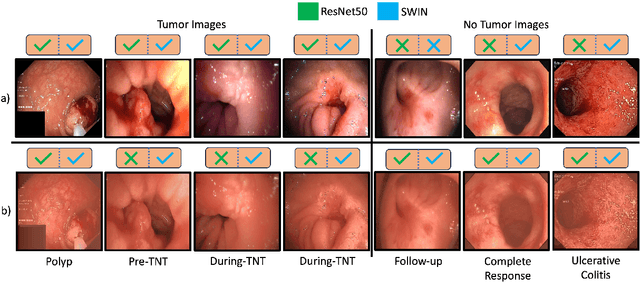 Figure 4 for Deep learning classifier of locally advanced rectal cancer treatment response from endoscopy images