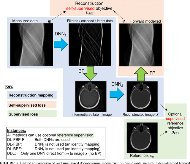 Figure 4 for Self-Supervised and Supervised Deep Learning for PET Image Reconstruction