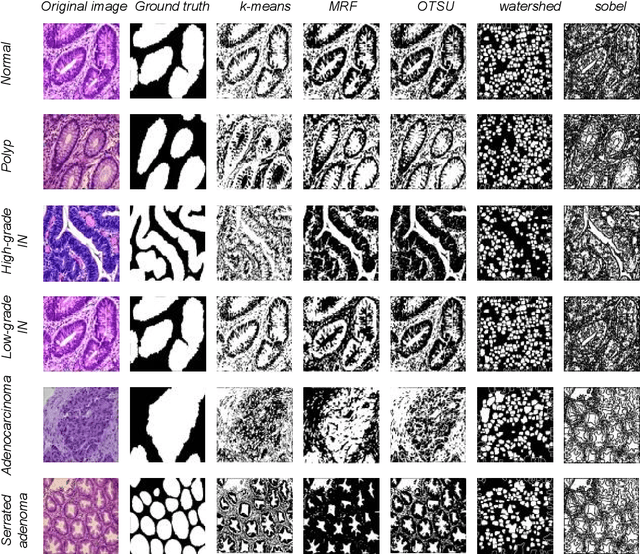 Figure 4 for EBHI-Seg: A Novel Enteroscope Biopsy Histopathological Haematoxylin and Eosin Image Dataset for Image Segmentation Tasks