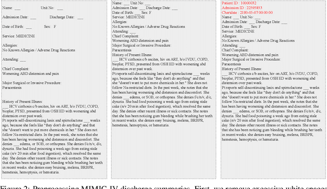 Figure 4 for EHRNoteQA: A Patient-Specific Question Answering Benchmark for Evaluating Large Language Models in Clinical Settings