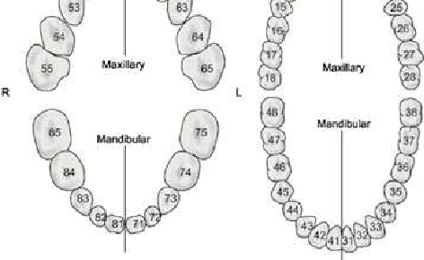 Figure 4 for Detection Transformer for Teeth Detection, Segmentation, and Numbering in Oral Rare Diseases: Focus on Data Augmentation and Inpainting Techniques