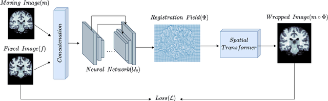 Figure 3 for A lightweight residual network for unsupervised deformable image registration