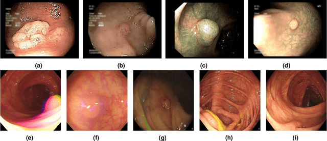 Figure 1 for Diverse Image Generation with Diffusion Models and Cross Class Label Learning for Polyp Classification