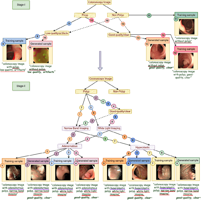 Figure 4 for Diverse Image Generation with Diffusion Models and Cross Class Label Learning for Polyp Classification