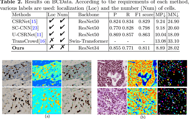 Figure 3 for Exploring Unsupervised Cell Recognition with Prior Self-activation Maps