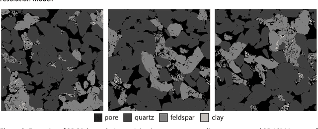 Figure 2 for Memory-Efficient Super-Resolution of 3D Micro-CT Images Using Octree-Based GANs: Enhancing Resolution and Segmentation Accuracy