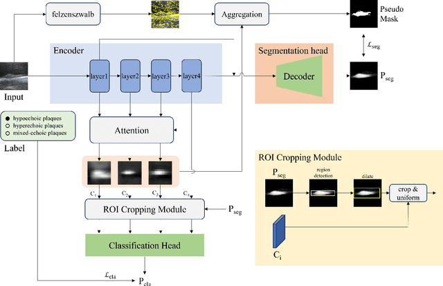 Figure 1 for WAL-Net: Weakly supervised auxiliary task learning network for carotid plaques classification